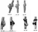Fig. 06 - VACUUM CLEANING DEVICE WITH FOLDABLE WAND TO PROVIDE STORAGE CONFIGURATION