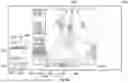 Fig. 44 - USER INTERFACE FOR CONCENTRIC INTERVENTIONAL DEVICES