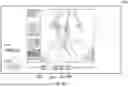 Fig. 46 - USER INTERFACE FOR CONCENTRIC INTERVENTIONAL DEVICES