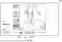 Fig. 47 - USER INTERFACE FOR CONCENTRIC INTERVENTIONAL DEVICES