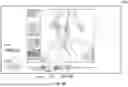 Fig. 50 - USER INTERFACE FOR CONCENTRIC INTERVENTIONAL DEVICES