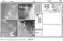 Fig. 76 - USER INTERFACE FOR CONCENTRIC INTERVENTIONAL DEVICES