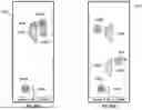 Fig. 84 - USER INTERFACE FOR CONCENTRIC INTERVENTIONAL DEVICES