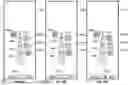 Fig. 85 - USER INTERFACE FOR CONCENTRIC INTERVENTIONAL DEVICES