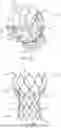 Fig. 02 - DEVICES AND METHODS FOR AORTIC VALVE PREPARATION PRIOR TO TRANSCATHETER PROSTHETIC VALVE PROCEDURES