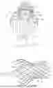 Fig. 06 - DEVICES AND METHODS FOR AORTIC VALVE PREPARATION PRIOR TO TRANSCATHETER PROSTHETIC VALVE PROCEDURES