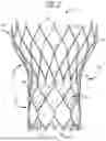 Fig. 02 - Transcatheter delivery system with wheel actuation