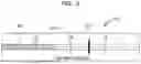 Fig. 08 - Transcatheter delivery system with wheel actuation