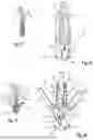 Fig. 08 - Delivery Catheter Handle And Methods Of Use