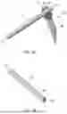Fig. 02 - SACROILIAC JOINT FIXATION