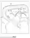 Fig. 06 - ANCHORING SYSTEM FOR UPPER LIMB BODY-POWERED PROSTHETICS HARNESS