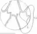 Fig. 01 - STENT HAVING ADJACENT ELEMENTS CONNECTED BY NARROW FLEXIBLE WEBS