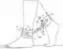 Fig. 01 - Ankle Support Device For Walking Therapy