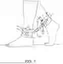 Fig. 02 - Ankle Support Device For Walking Therapy