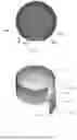 Fig. 02 - LASIK FLAP CUTTING PATTERNS INCLUDING INTRASTROMAL POCKET FOR BUBBLE MANAGEMENT