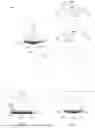 Fig. 06 - LASIK FLAP CUTTING PATTERNS INCLUDING INTRASTROMAL POCKET FOR BUBBLE MANAGEMENT