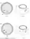 Fig. 07 - LASIK FLAP CUTTING PATTERNS INCLUDING INTRASTROMAL POCKET FOR BUBBLE MANAGEMENT