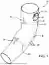 Fig. 02 - VIBRATING GARMENT ASSEMBLY