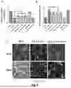 Fig. 05 - HUMAN PLURIPOTENT STEM CELL-DERIVED SECRETOME AS A BIOLOGIC FOR PREVENTION AND TREATMENT OF NEURODEGENERATIVE AND APOPTOTIC DISEASES