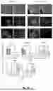Fig. 45 - HUMAN PLURIPOTENT STEM CELL-DERIVED SECRETOME AS A BIOLOGIC FOR PREVENTION AND TREATMENT OF NEURODEGENERATIVE AND APOPTOTIC DISEASES