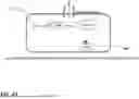 Fig. 72 - MICROORGANISMS PROGRAMMED TO PRODUCE IMMUNE MODULATORS AND ANTI-CANCER THERAPEUTICS IN TUMOR CELLS
