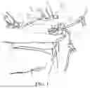 Fig. 02 - ROTARY PERITONEAL DIALYSIS INTERCONNECT