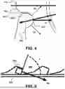 Fig. 05 - Wheel chock and method