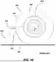 Fig. 25 - Wheel chock and method