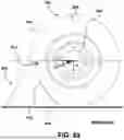 Fig. 26 - Wheel chock and method