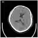 Fig. 01 - SYSTEMS AND METHODS FOR DETERMINING PARAMETERS FOR MEDICAL IMAGE PROCESSING