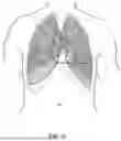 Fig. 07 - MEDICAL DEVICE WITH ACOUSTIC SENSOR