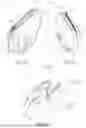 Fig. 02 - APPARATUS AND METHOD FOR REMOVING TISSUE