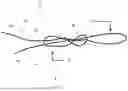 Fig. 02 - Slip knot suture construct