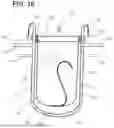 Fig. 09 - DEVICE, SYSTEM AND METHOD FOR INTERMITTENT DISPLACEMENT OF BLOOD TO MITIGATE PERIPHERAL NERVE NEUROPATHY