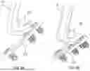 Fig. 07 - CERVICAL LAMINOPLASTY INSTRUMENTS AND PROCEDURES