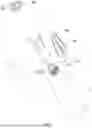 Fig. 02 - DEVICE FOR MIXING BONE CEMENT