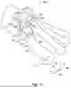 Fig. 06 - PATIENT-SPECIFIC OSTEOTOMY INSTRUMENTATION