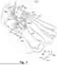 Fig. 07 - PATIENT-SPECIFIC OSTEOTOMY INSTRUMENTATION