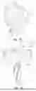 Fig. 09 - PATIENT-SPECIFIC OSTEOTOMY INSTRUMENTATION
