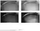 Fig. 10 - SYSTEM AND METHOD FOR ENHANCED DATA ANALYSIS WITH SPECIALIZED VIDEO ENABLED SOFTWARE TOOLS FOR MEDICAL ENVIRONMENTS