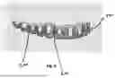 Fig. 07 - APPARATUS, SYSTEM AND METHOD FOR DIRECT BONDING OF ORTHODONTIC BRACKETS