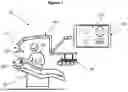 Fig. 02 - METHOD OF GENERATING MANUFACTURING PARAMETERS DURING A DENTAL PROCEDURE FOR A DENTAL PROSTHESIS