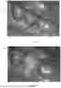 Fig. 02 - SEMI-AUTOMATIC TOOTH SEGMENTATION