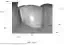 Fig. 03 - SEMI-AUTOMATIC TOOTH SEGMENTATION
