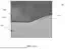 Fig. 07 - SEMI-AUTOMATIC TOOTH SEGMENTATION