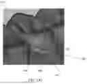 Fig. 10 - SEMI-AUTOMATIC TOOTH SEGMENTATION
