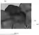 Fig. 12 - SEMI-AUTOMATIC TOOTH SEGMENTATION