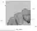 Fig. 17 - SEMI-AUTOMATIC TOOTH SEGMENTATION