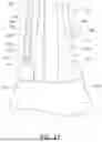Fig. 22 - ORAL CARE IMPLEMENT AND REPLACEMENT HEAD THEREOF
