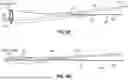 Fig. 22 - LOW PROFILE EMBOLIC PROTECTION DEVICE AND SYSTEM
